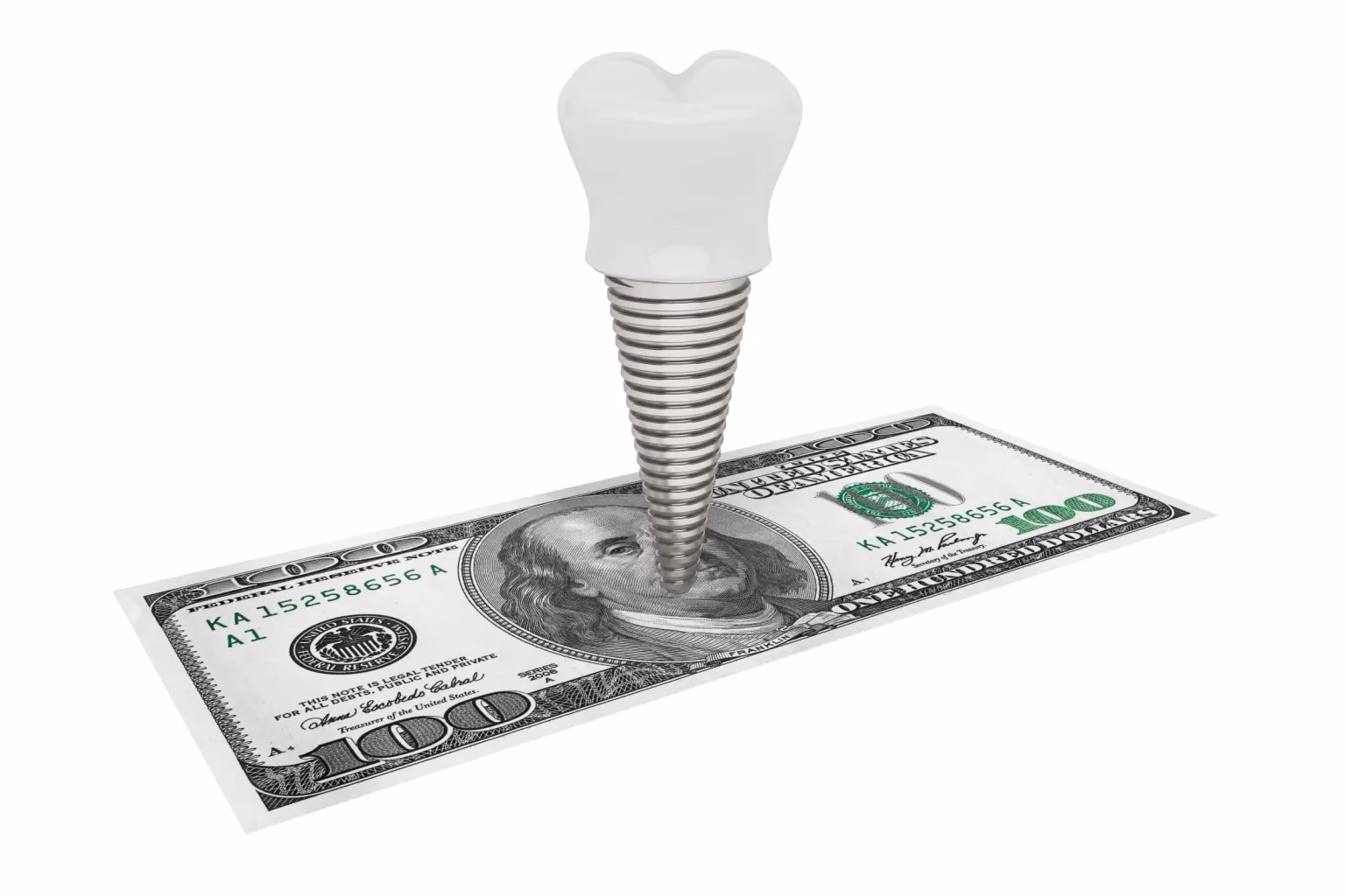 Why Second Opinions Matter: Ensuring You’re Not Being Overcharged